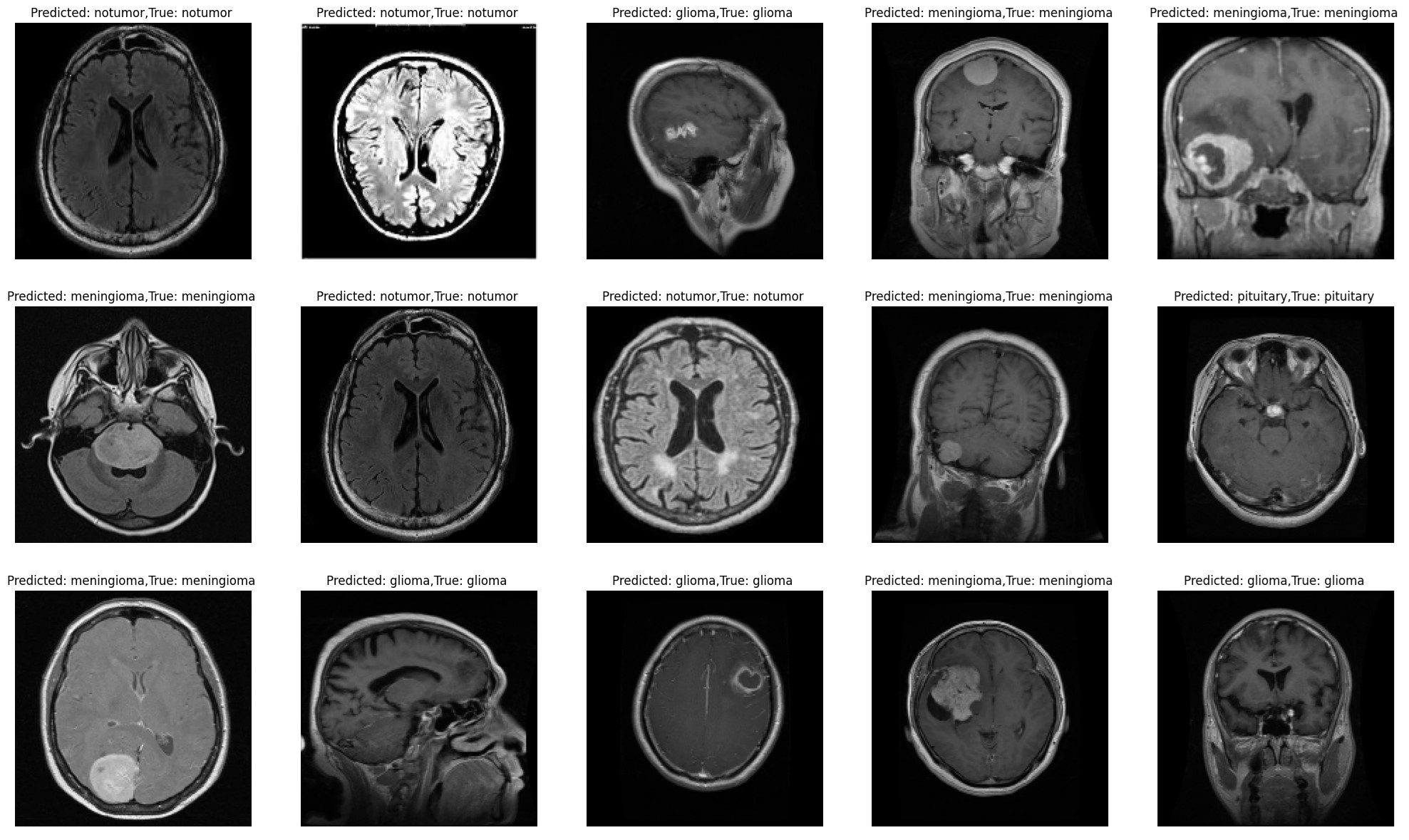 Brain Tumor MRI